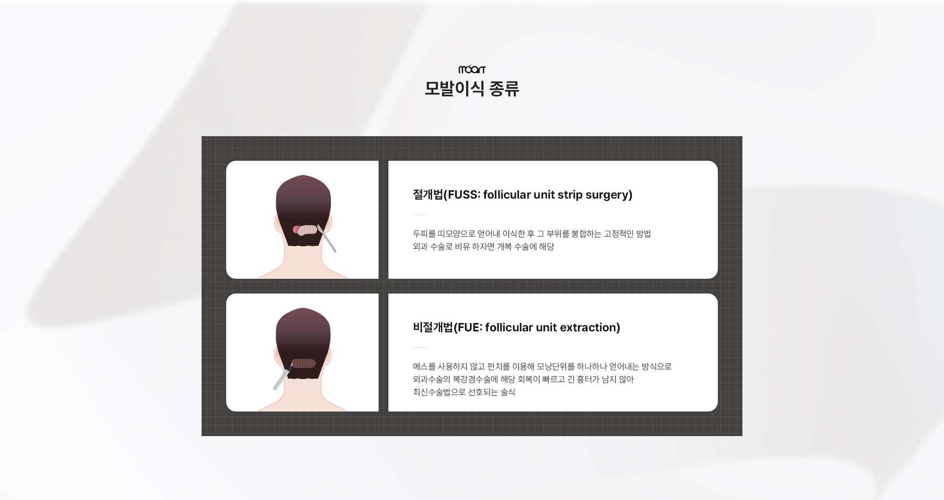 비절개 모발이식 상세03