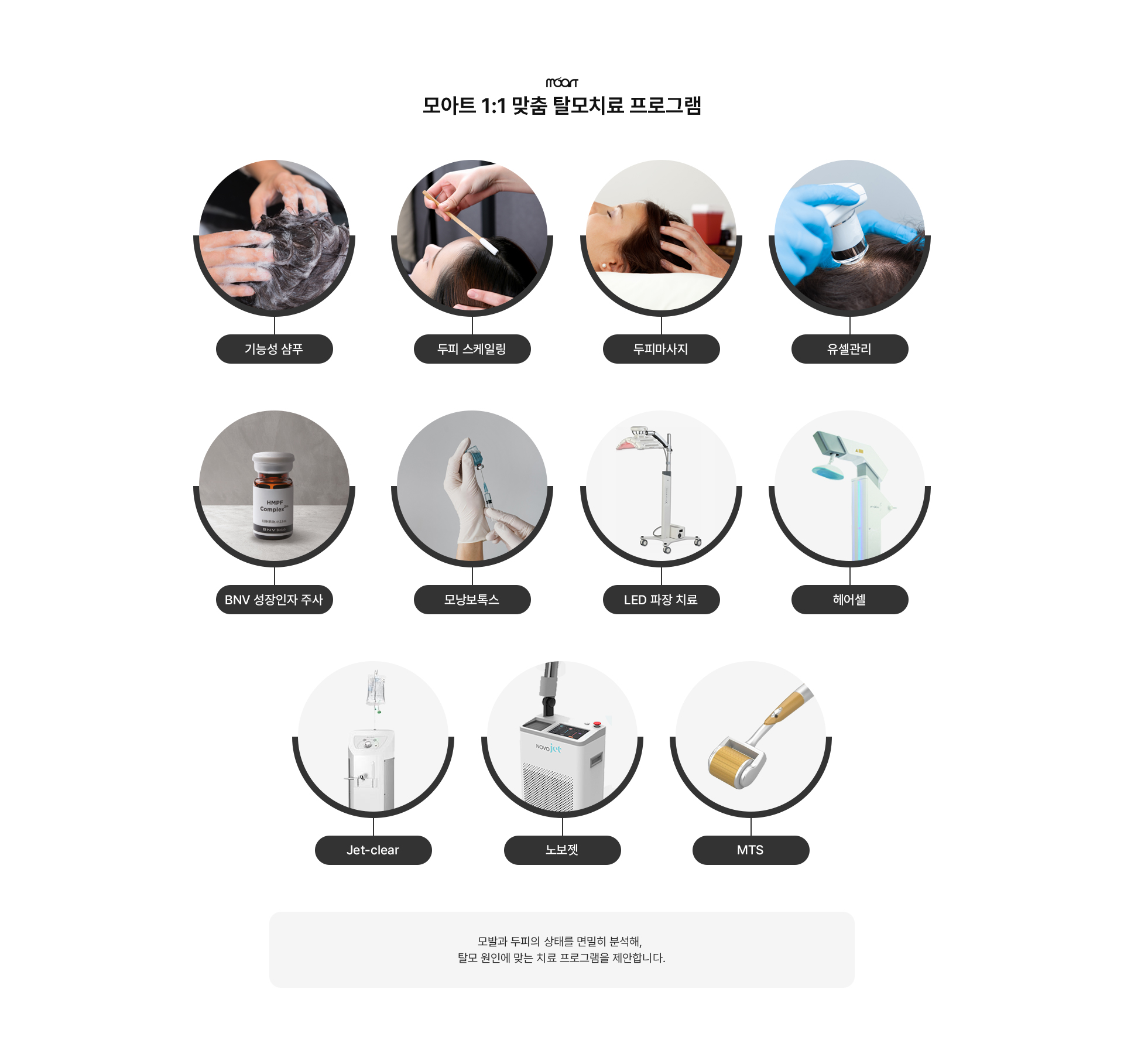 탈모치료 상세04